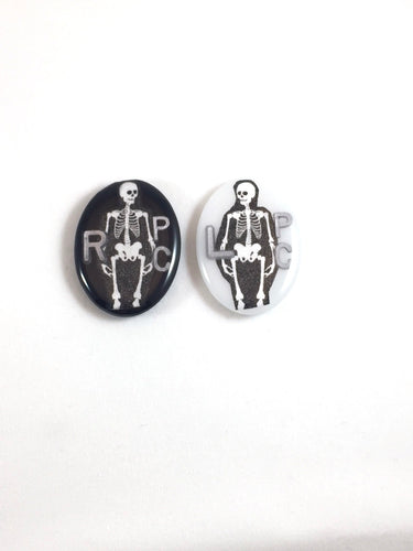 Skeleton X-ray Markers